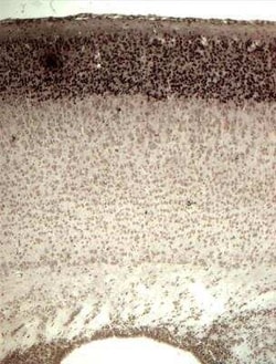 CDP/CUTL1 Antibody (2A10), Novus Biologicals 0.1 mg, Unconjugated:Antibodies,