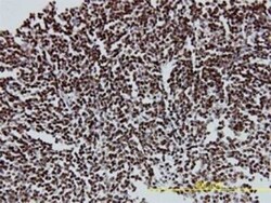 CDP/CUTL1 Antibody (2A10), Novus Biologicals 0.1 mg, Unconjugated:Antibodies,