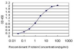 CDP/CUTL1 Antibody (2D10), Novus Biologicals 0.1 mg | Buy Online | Novus Biologicals | Fisher Scientific