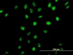 CDP/CUTL1 Antibody, Novus Biologicals 0.05 mg | Buy Online | Novus Biologicals | Fisher Scientific
