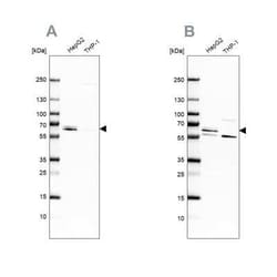 CDR2 Antibody, Novus Biologicals 25 &mu;L; Unconjugated:Antibodies, Polyclonal