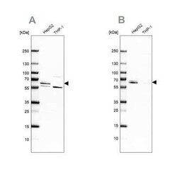 CDR2 Antibody, Novus Biologicals 25 &mu;L; Unconjugated:Antibodies, Polyclonal