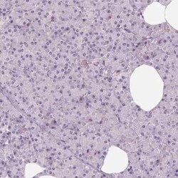 CDS1 Antibody, Novus Biologicals:Antibodies:Primary Antibodies