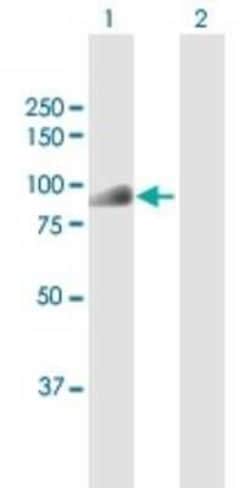 CDT2 Antibody, Novus Biologicals 0.1 mg | Buy Online | Novus Biologicals | Fisher Scientific