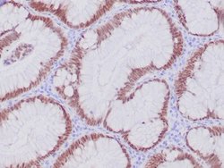CDX2 Antibody (CDX2/4394R) - Azide and BSA Free, Novus Biologicals 100