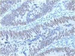 CDX2 Antibody (PCRP-CDX2-1A3), Novus Biologicals:Antibodies:Primary Antibodies