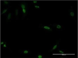 CDX4 Antibody (1E9), Novus Biologicals 0.1 mg; Unconjugated:Antibodies,
