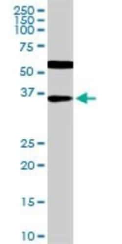 CDX4 Antibody (1E9), Novus Biologicals 0.1 mg; Unconjugated:Antibodies,
