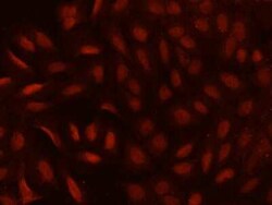 CDYL Antibody, Novus Biologicals 50 &mu;g | Buy Online | Novus Biologicals | Fisher Scientific