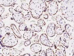 CDYL Antibody, Novus Biologicals 50 &mu;g | Buy Online | Novus Biologicals | Fisher Scientific