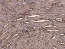 CEACAM5/CD66e Antibody (Arcitumomab) - Azide and BSA Free, Novus Biologicals