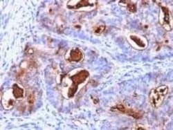 CEACAM5/CD66e Antibody (C66/1260), Novus Biologicals:Antibodies:Primary