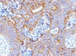 CEACAM5/CD66e Antibody (C66/1291), Novus Biologicals 100&mu;g; Unlabeled:Antibodies,