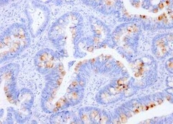 CEACAM5/CD66e Antibody (C66/1291), Novus Biologicals 100&mu;g; Unlabeled:Antibodies,
