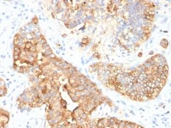 CEACAM5/CD66e Antibody (SPM330), Novus Biologicals 0.1mg; Unlabeled:Antibodies,