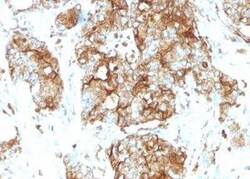 CEACAM5/CD66e Antibody (SPM584), Novus Biologicals 0.1 mg; Unconjugated:Antibodies,