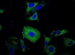CEACAM6/CD66c Rabbit anti-Human, Clone: 408, Novus Biologicals:Antibodies:Primary