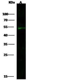 CEACAM6/CD66c Rabbit anti-Human, Clone: 408, Novus Biologicals:Antibodies:Primary