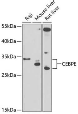 CEBP epsilon Antibody - BSA Free, Novus Biologicals 0.1 mL, Unconjugated:Anticuerpos