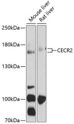 CECR2 Antibody - BSA Free, Novus Biologicals 0.1 mL, Unconjugated:Antibodies,