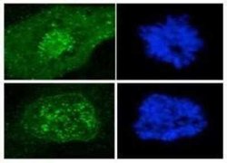 CENPF Antibody (7F11.2), Novus Biologicals 100 &mu;g | Buy Online | Novus Biologicals | Fisher Scientific