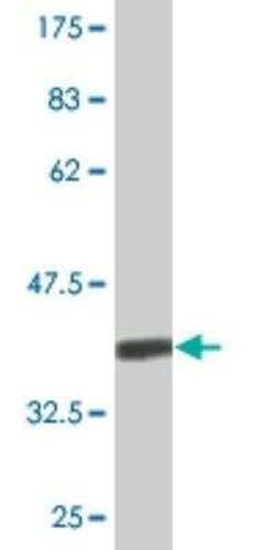 CENPK Antibody (4D11), Novus Biologicals 0.1 mg; Unconjugated:Antibodies,