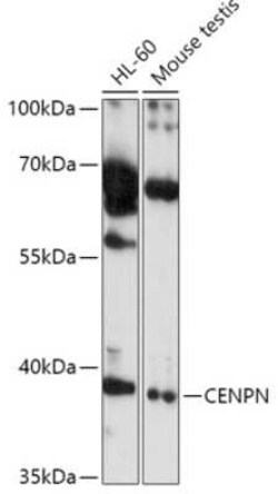 CENPN Antibody - Azide and BSA Free, Novus Biologicals 0.02 mL | Buy Online | Novus Biologicals | Fisher Scientific
