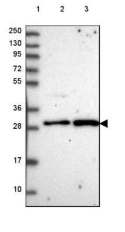 CENPQ Antibody, Novus Biologicals 25 &mu;L, Unconjugated:Antibodies, Polyclonal