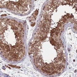 CEP110 Antibody, Novus Biologicals 25 &mu;L, Unconjugated:Antibodies, Polyclonal