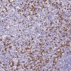 CEP120 Antibody, Novus Biologicals 25 &mu;L, Unconjugated:Antibodies, Polyclonal