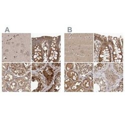CEP350 Antibody, Novus Biologicals 25 &mu;L | Buy Online | Novus Biologicals | Fisher Scientific