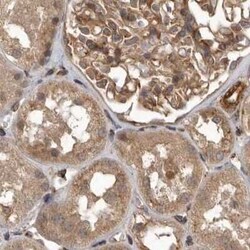 CEP350 Antibody, Novus Biologicals 25 &mu;L | Buy Online | Novus Biologicals | Fisher Scientific