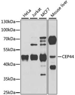 CEP44 Antibody - BSA Free, Novus Biologicals:Antibodies:Primary Antibodies