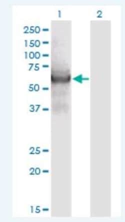 Novus Biologicals CEP55 Antibody (6A10), Novus Biologicals 100 &mu;g | Buy Online | Novus Biologicals&trade; | Fisher Scientific