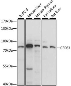 CEP63 Antibody - Azide and BSA Free, Novus Biologicals 0.02 mL, Unconjugated:Antibodies,