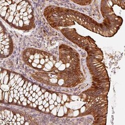 CEP95 Antibody, Novus Biologicals 25 &mu;L, Unconjugated:Antibodies, Polyclonal