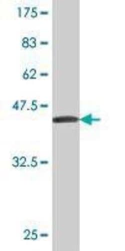 Carboxylesterase 2/CES2 Antibody (4E3), Novus Biologicals 0.1 mg | Buy Online | Novus Biologicals | Fisher Scientific