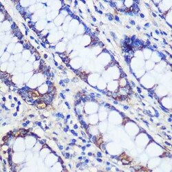 CFAP61 Antibody - Azide and BSA Free, Novus Biologicals 0.1 mL, Unconjugated:Antibodies,