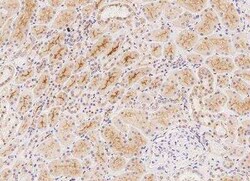 CFAP97D1 Antibody, Novus Biologicals:Antibodies:Primary Antibodies