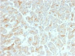 CFTR Mouse anti-Human, Mouse, Clone: rCFTR/1342, Novus Biologicals:Antibodies:Primary