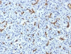CFTR Antibody (CFTR/1643), Novus Biologicals 20 &mu;g | Buy Online | Novus Biologicals | Fisher Scientific