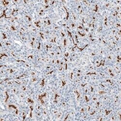 CFTR Antibody, Novus Biologicals 25 &mu;L | Buy Online | Novus Biologicals | Fisher Scientific