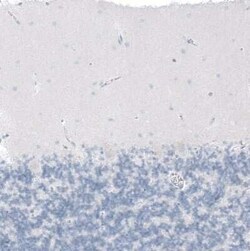 CFTR Antibody, Novus Biologicals 25 &mu;L | Buy Online | Novus Biologicals | Fisher Scientific