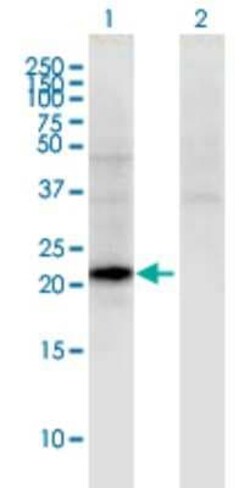 CGB5 Antibody (2E7), Novus Biologicals 0.1 mg | Buy Online | Novus Biologicals | Fisher Scientific