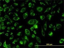 CGI-16 Antibody (4E4), Novus Biologicals 0.1 mg | Buy Online | Novus Biologicals | Fisher Scientific