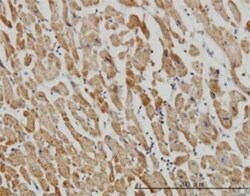 CGI-16 Antibody (4E4), Novus Biologicals 0.1 mg | Buy Online | Novus Biologicals | Fisher Scientific
