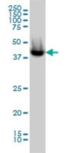 CGI-16 Antibody (4E4), Novus Biologicals 0.1 mg | Buy Online | Novus Biologicals | Fisher Scientific