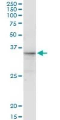CGREF1 Antibody (2D7), Novus Biologicals 0.1 mg | Buy Online | Novus Biologicals | Fisher Scientific