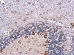 CGRP1 Antibody, Novus Biologicals 100 &mu;g | Buy Online | Novus Biologicals | Fisher Scientific