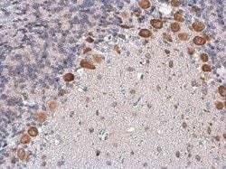 CGRP1 Antibody, Novus Biologicals 100 &mu;g | Buy Online | Novus Biologicals | Fisher Scientific